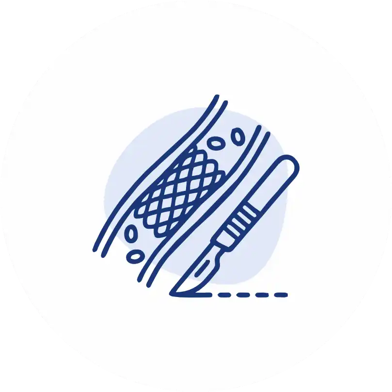 Vascular Surgery