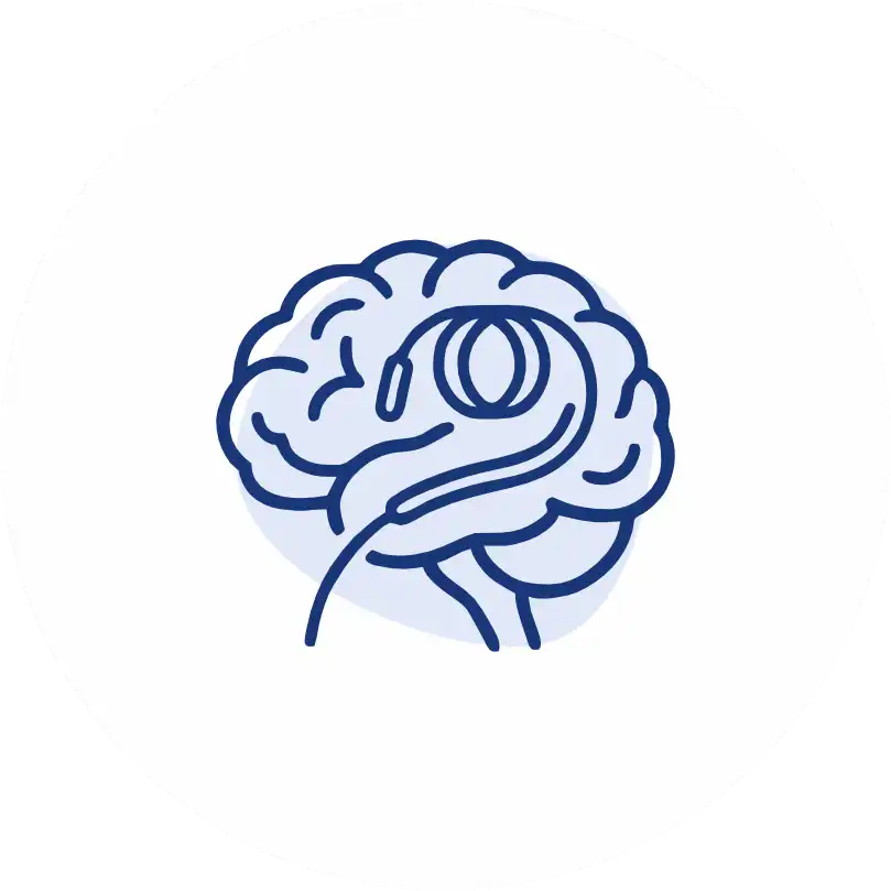 Interventional Neurology