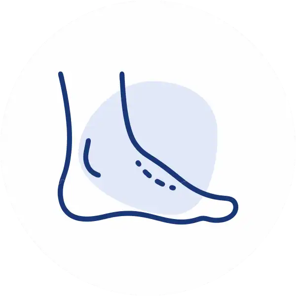 Diabetic Foot Surgery